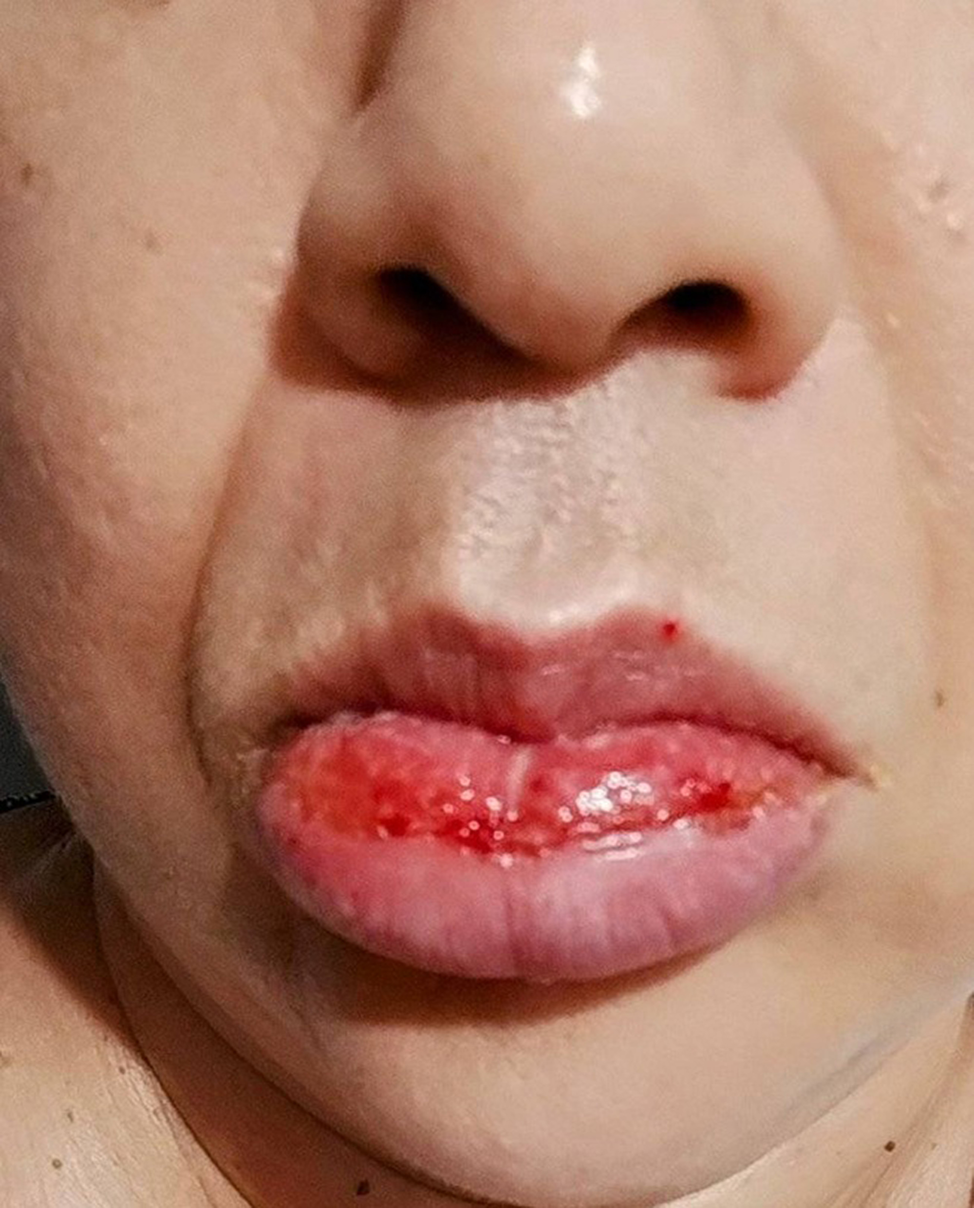 Denise Correia Santiago, 45, shows her lips in undated photo. She suffered an allergic reaction after using toothpaste, in Miracatu, Brazil. Note: Private photo taken from social media. Denise Correia Santiago