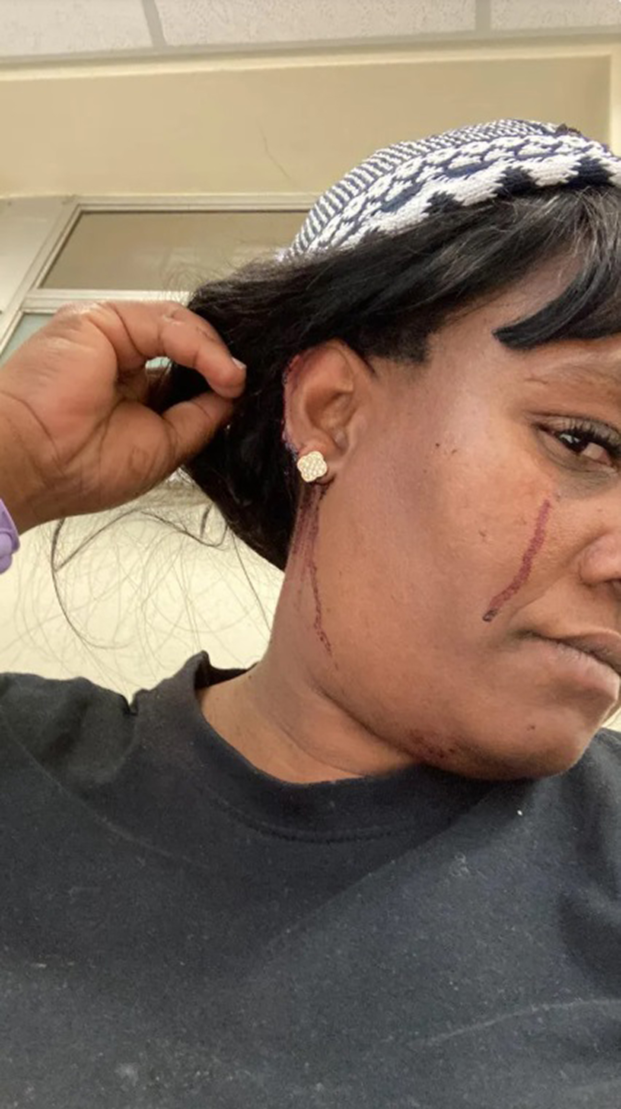 Picture shows injured Aqeela Benjamin, undated. They were robbed in Browns Farm, Philippi, South Africa. Note: Private photo taken from local media. Aqeela Benjamin