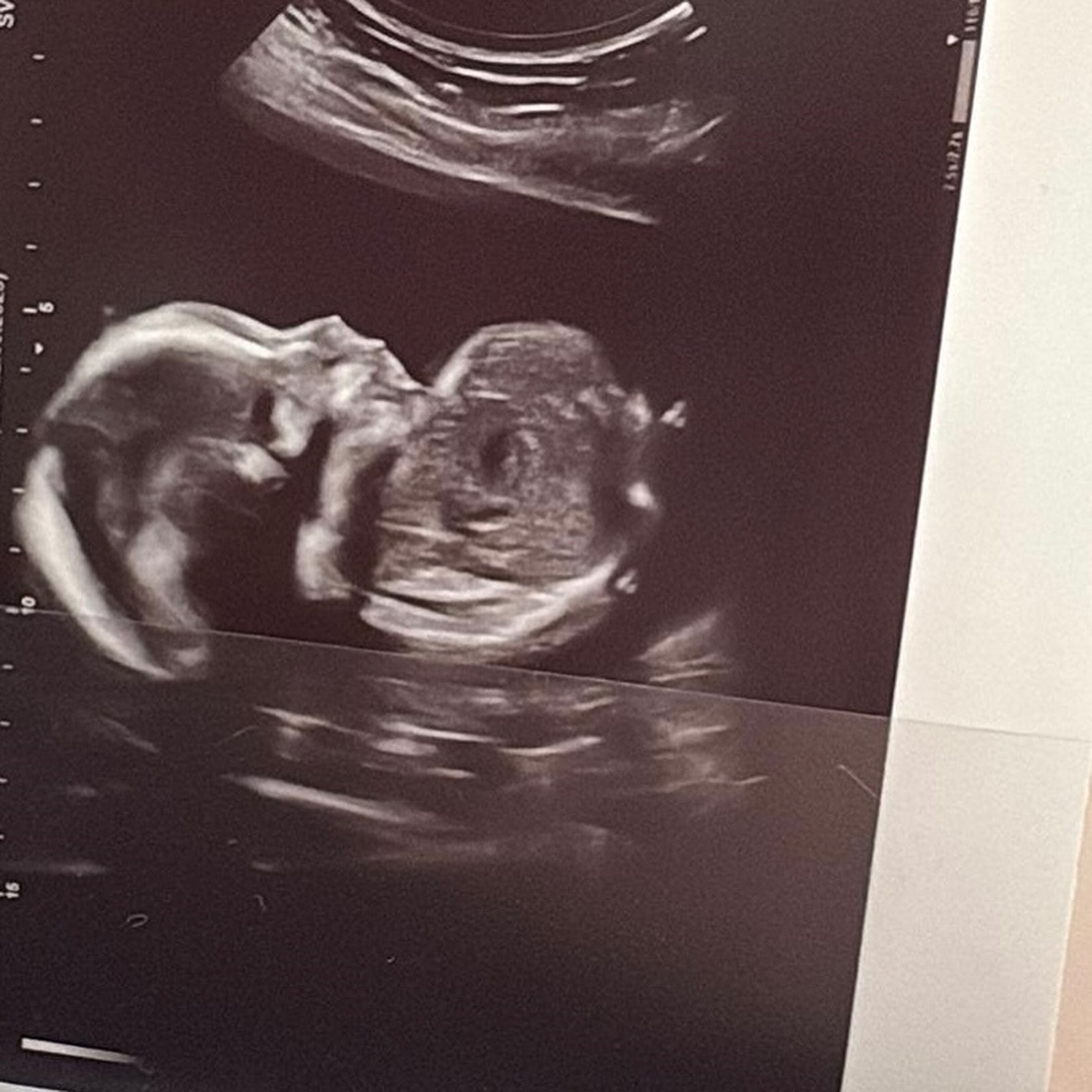 Picture shows and image of the baby daughter, undated. Rapper 18 Karat fathers another child in prison in Dortmund, Germany. Note: Private photo taken from social media. Rapper 18 Karat