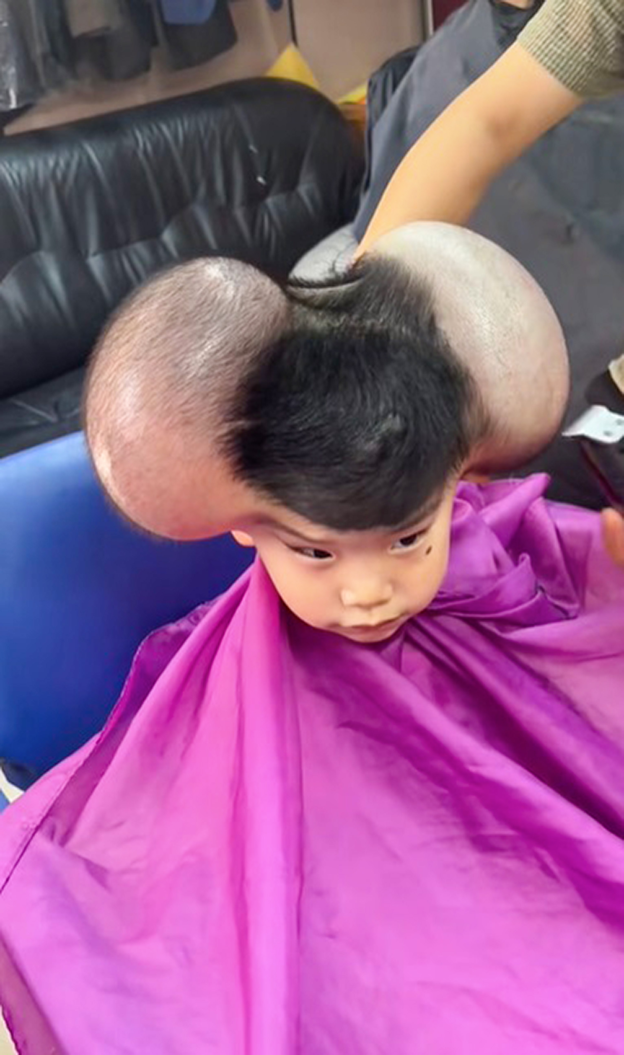 the three-year-old boy who was teased for looking like Mickey Mouse