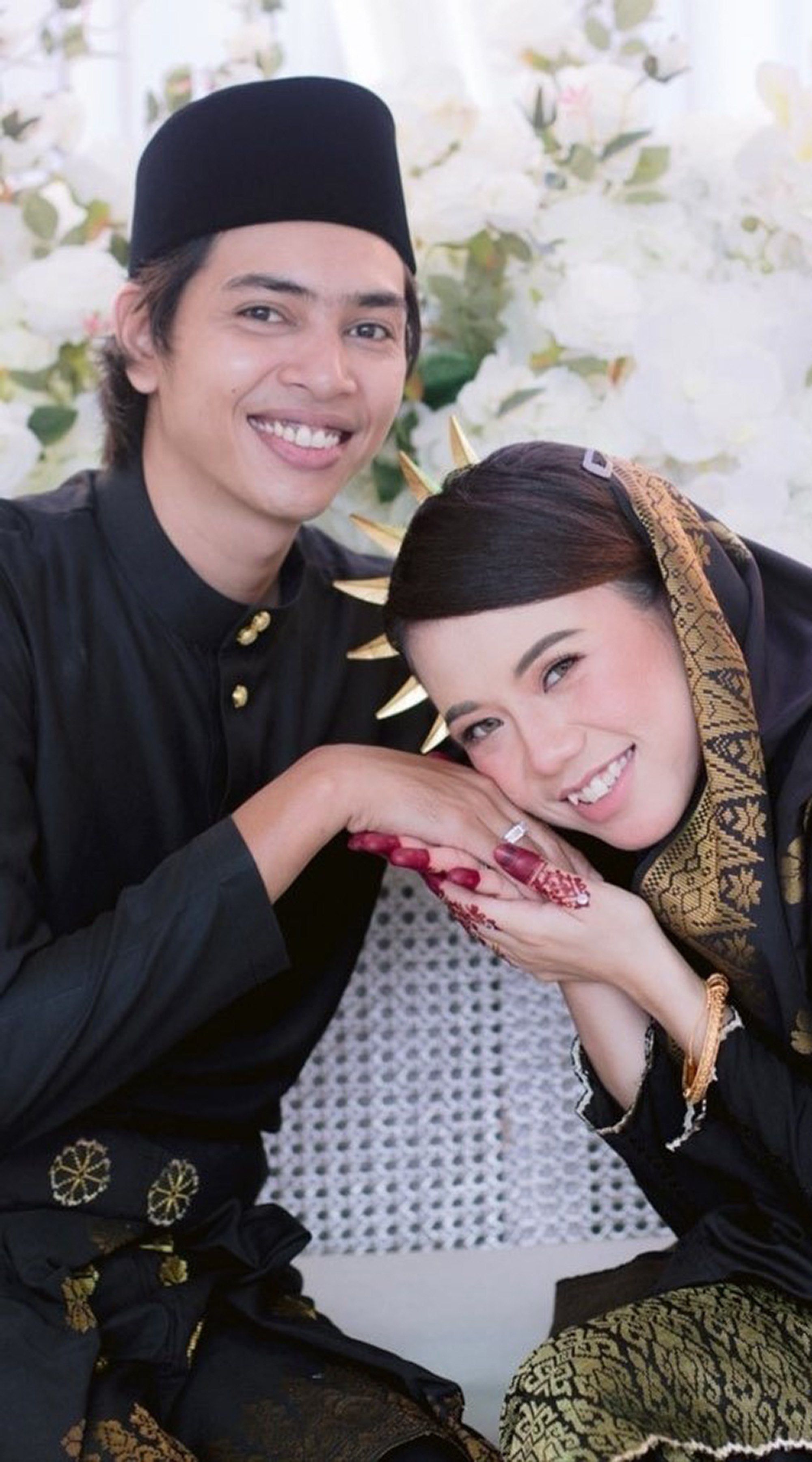 Malaysian woman called Farah poses in undated photo before experiencing changes. She suffers from facial acne during pregnancy. Note: Private photo taken from social media. Farah