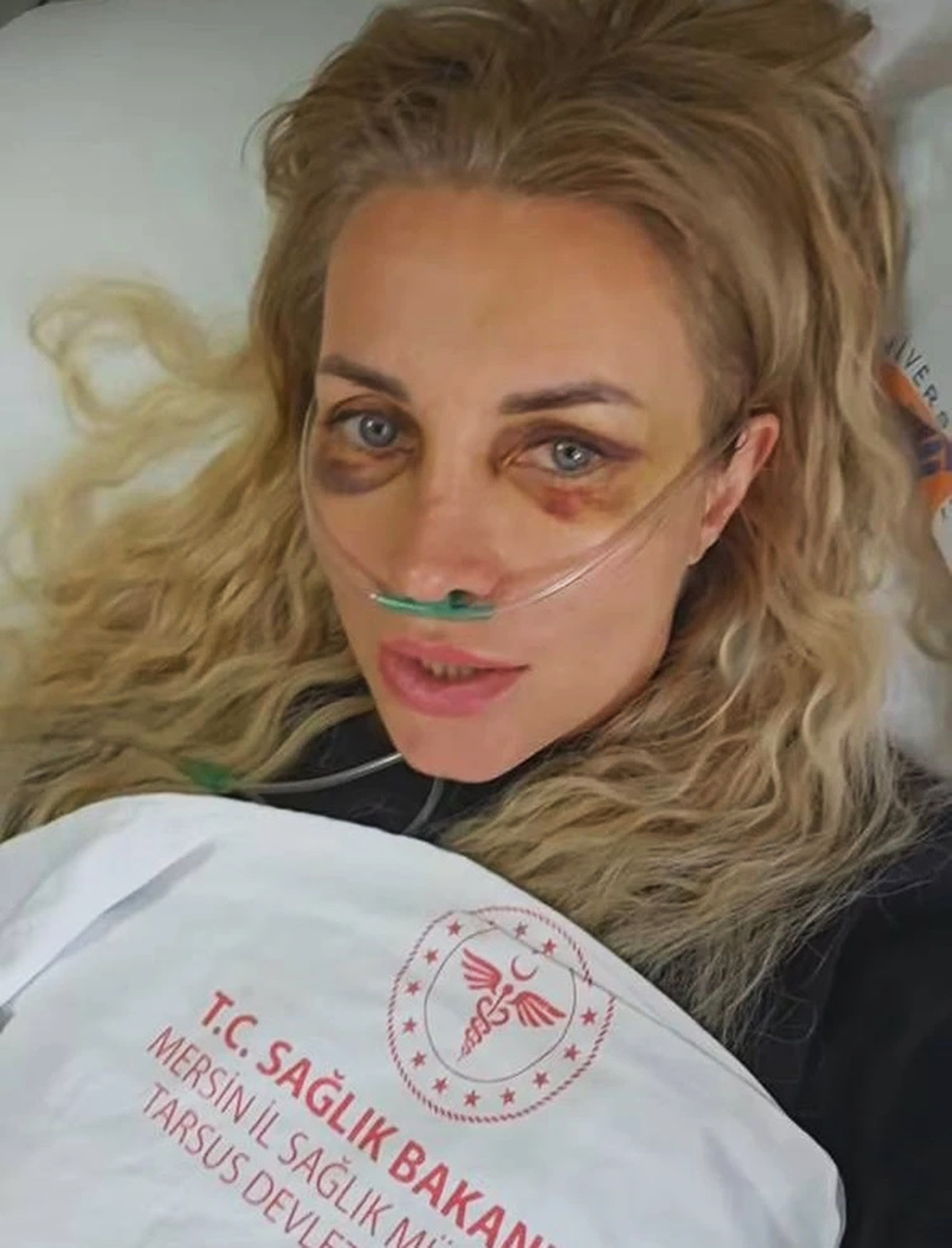Picture shows Moscow model named only as Olivia, 38, undated photo. She experienced clinical death after falling from 9th floor in Turkey. Note: Private photo. Olivia