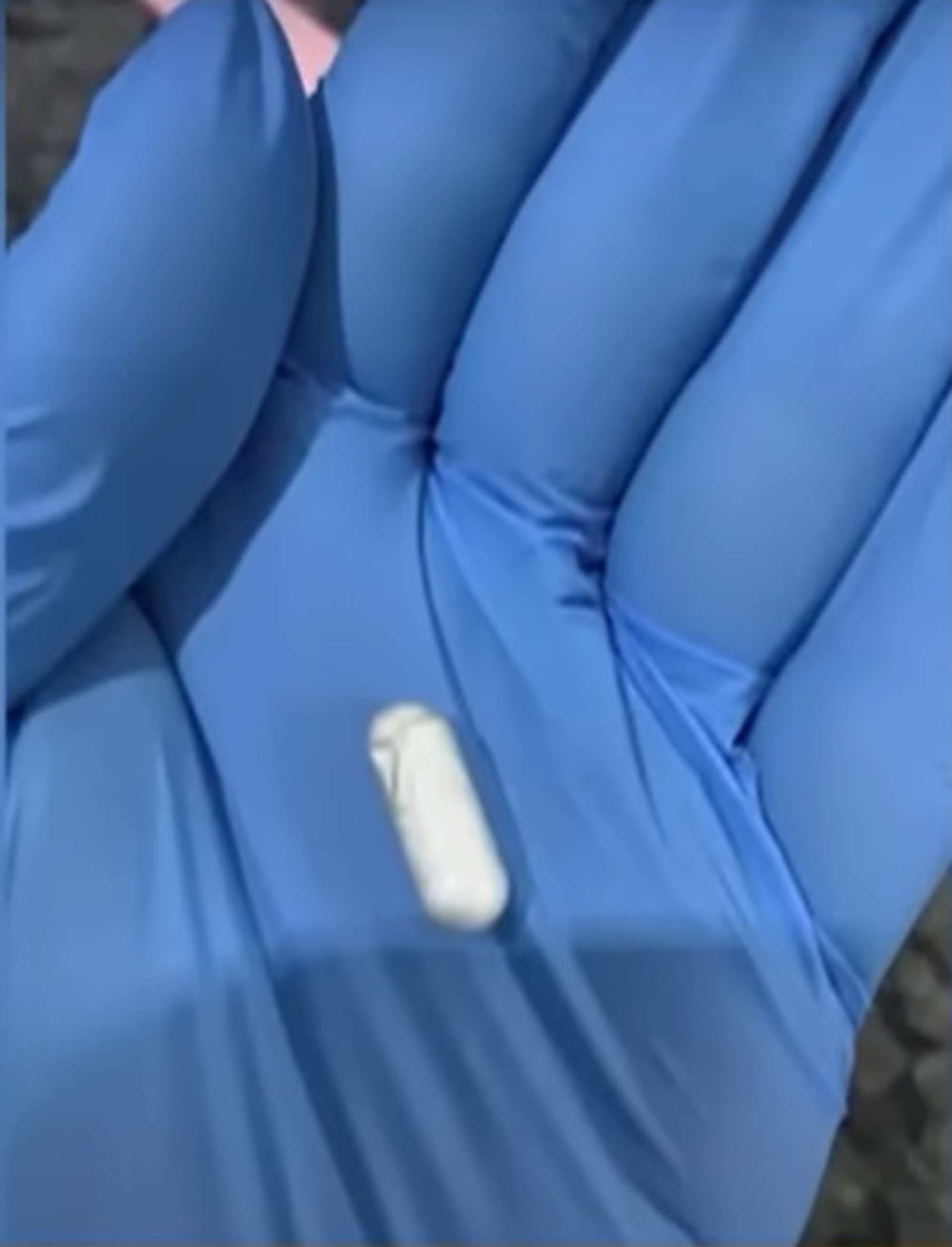 Picture shows material seized that was used during the illegal abortion