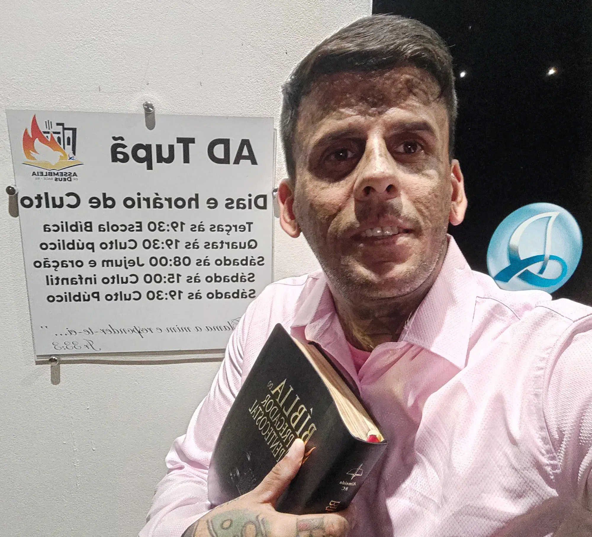 Leandro de Souza from the city of Bage, Rio Grande do Sul State, Brazil, poses in undated photo. He is undergoing laser treatments to remove the tattoos from his face. Note: Private photo from social media. 1747164893927-0uchhgm0.jpg
