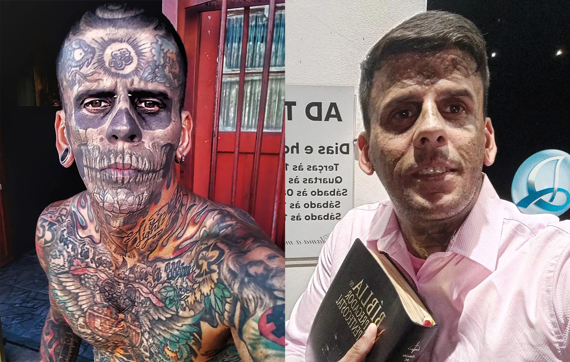 Picture shows Leandro de Souza before the procedure (left) and after (right), undated. He had 95% of his body covered in tattoos. 1747165001017-pv8ghmhi.jpg