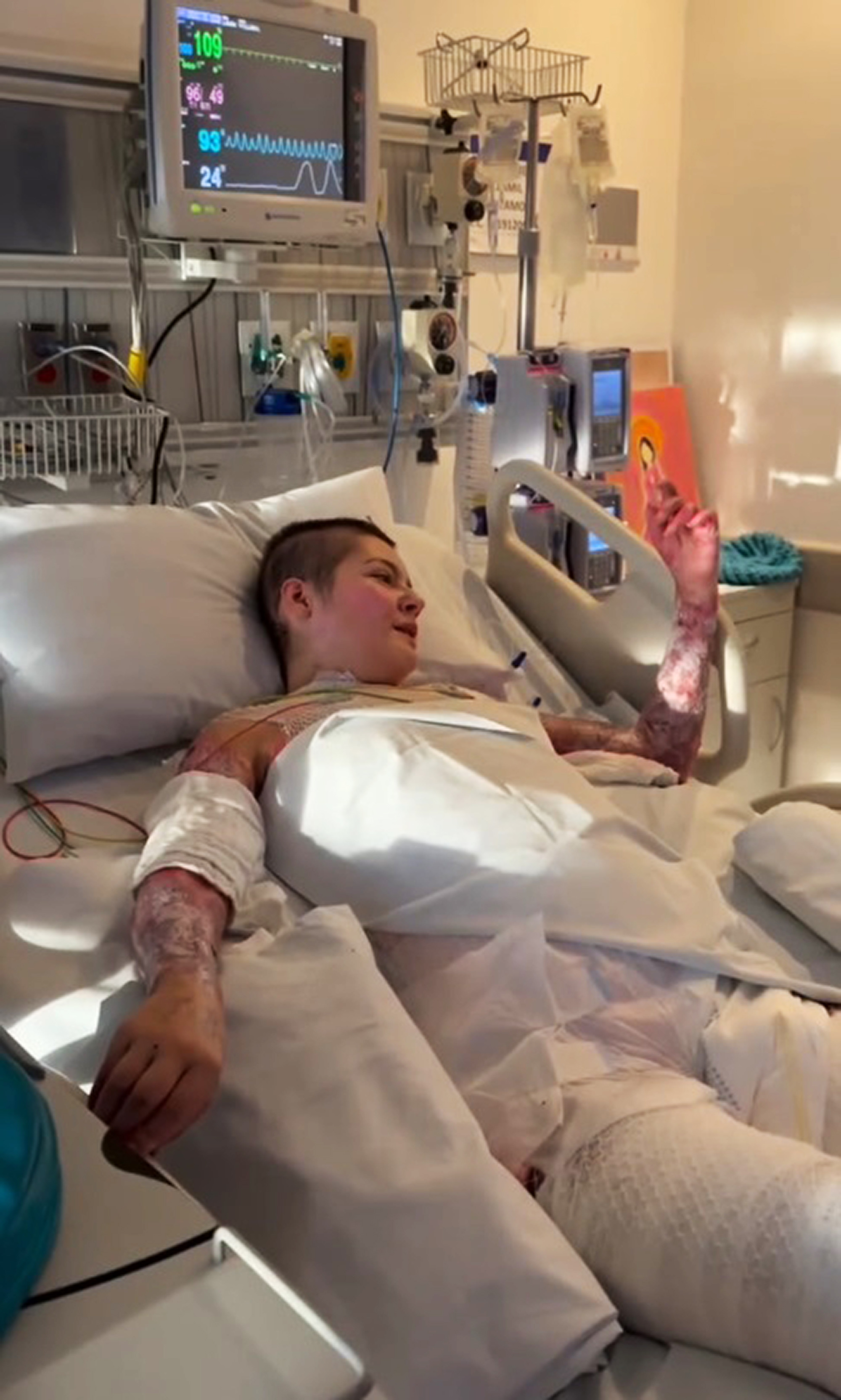 Laura Villamil lies in hospital bed, undated. She suffered severe burns over 90 percent of her body while performing at the well-known Andres Carne de Res restaurant in Chia, Cundinamarca in Colombia. 1747336764753-jtuzr7ns.jpg